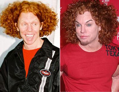 Carrot Top steroids